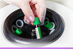 Плазмолифтинг – верни время вспять…